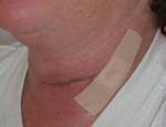 The bandaid holds it all together